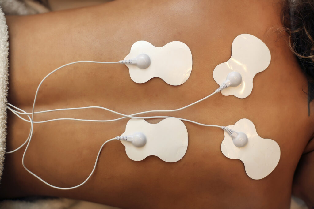 Young woman during a electrical stimulation therapy.