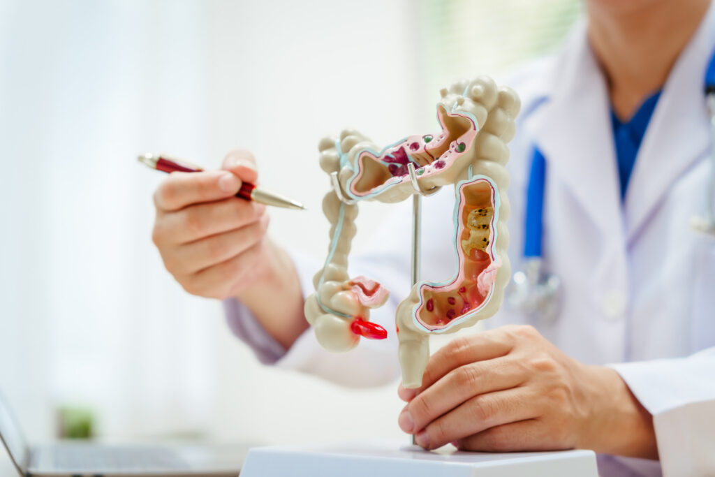 A male doctor wearing glasses sits at a desk, explaining an intestinal model, discussing anatomy, small and large intestine functions, colitis, colon cancer, appendicitis symptoms,digestive health